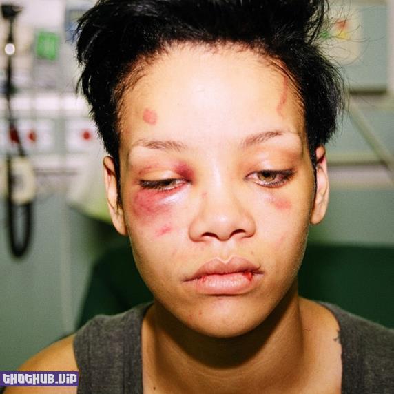Rihanna get beaten up by Chris Brown