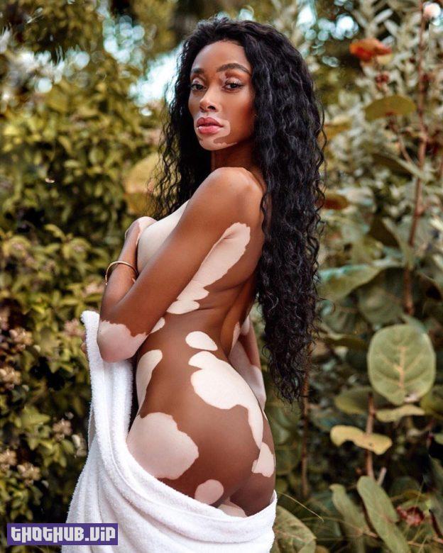 1665618621 560 Winnie Harlow TheFappening Sexy 16 Photos
